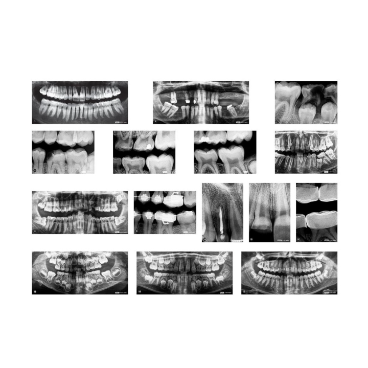 Röntgenpildid "Hambad", 15tk