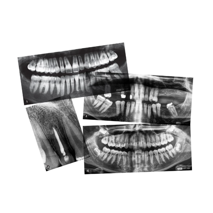 Röntgenpildid "Hambad", 15tk